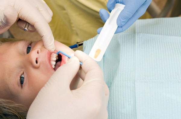 Young boy receiving fluoride treatment at Cramer Dental in Blue Bell, PA